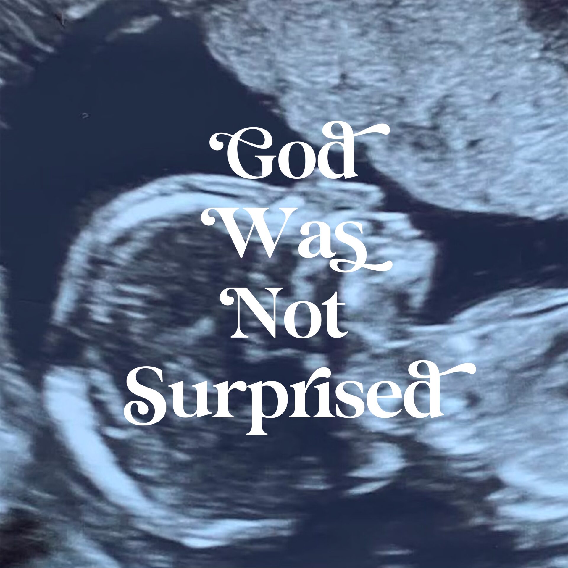 God Was Not Surprised Cover Image